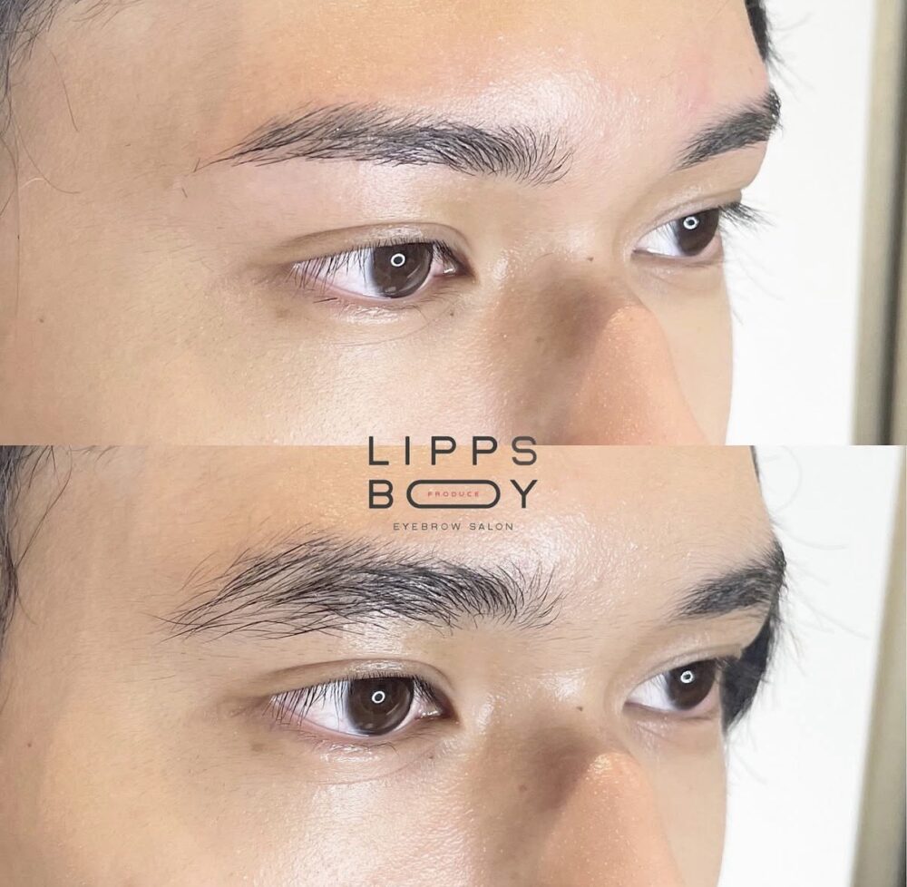LIPPSビフォーアフター