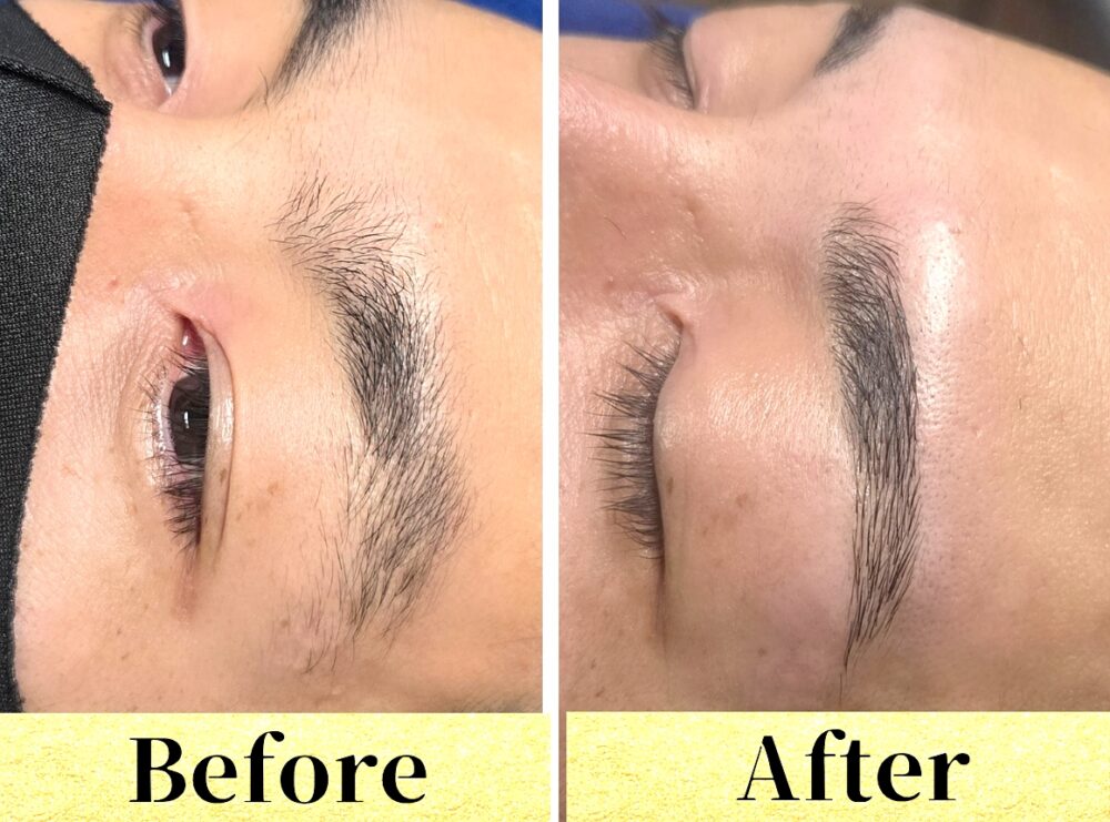 アポロビフォーアフター